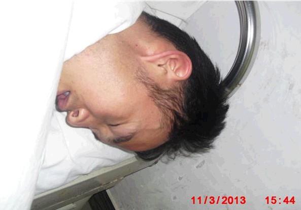 剧烈的疼痛让他无法忍受,县里的医生迅速联系市人民医,即时送往市里