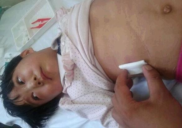 女儿疼的出了一头的汗,疼的哭了好半天,我看到了她的坚强和无奈,我不会放弃孩子,求大家帮帮我吧!!!!