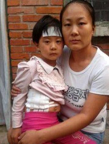 这是前几天从北京解放军316化疗回来照的,又发烧了,高烧不退。