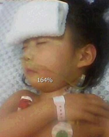 这是我女儿第二次肝母细胞瘤复发,在北京解放军316医院化疗的时候照的,当时发烧。