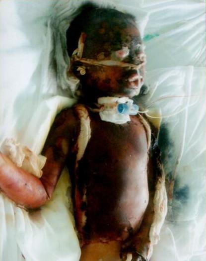 小浩东最初受伤时的照片。