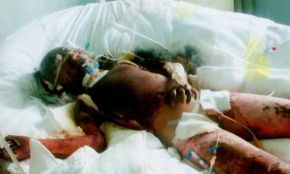 那个时候真的是惨不忍睹