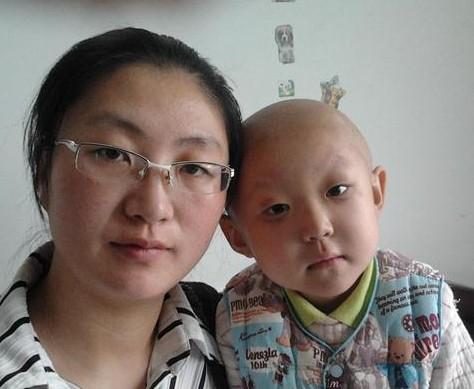 因为每天吃激素药,脸都虚肿了,眼圈黑黑的