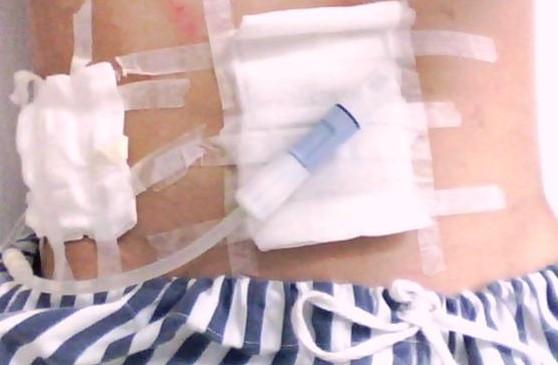 儿子每次看到我这么难受都会说爸爸不疼,我给你揉揉