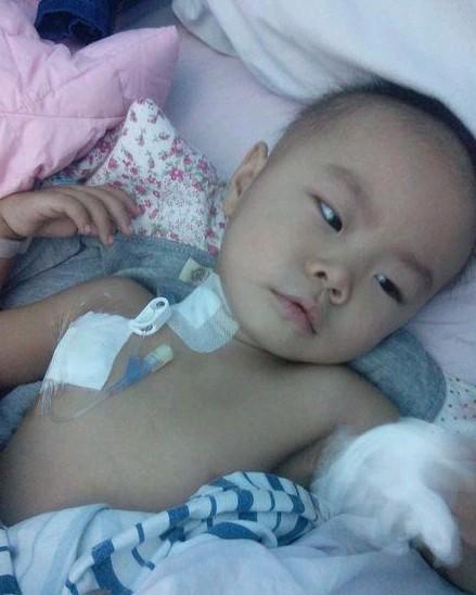 由于化疗药物伤到静脉血管,小宝怡动手术做了个输液管