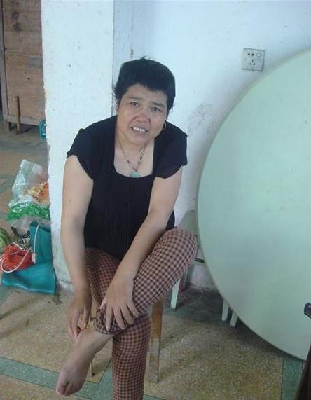 陈妃桃的腿脚行动不便