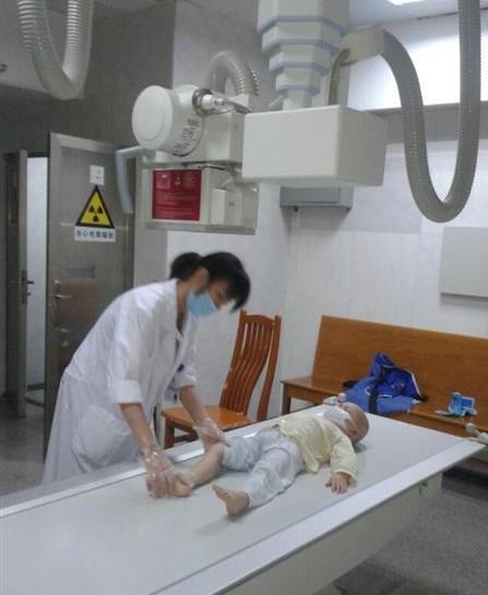 脚痛检查中,化疗药物越来越重,导致钙流失,脚痛。