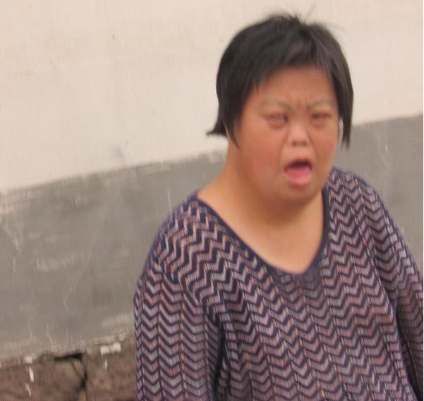 吴筱贞的眼睛也天生的不好,舌头总是向外吐着