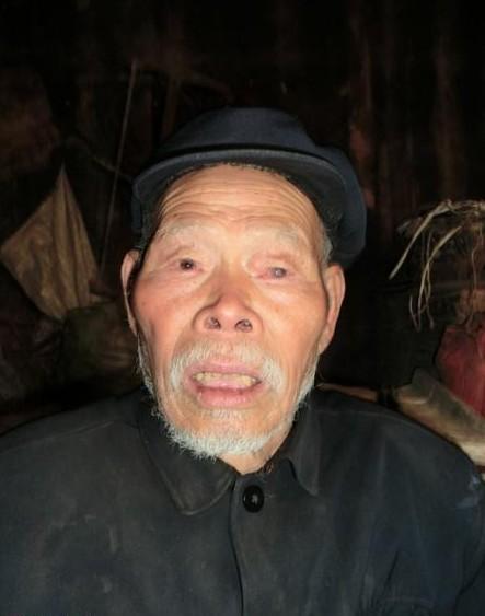 李金贵老人的近照,老人的左眼患有白内障现在已经看不见东西了