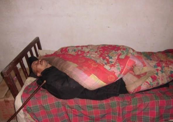 程远贵患高血压偏瘫,生活不能自理,就经常躺在床上。