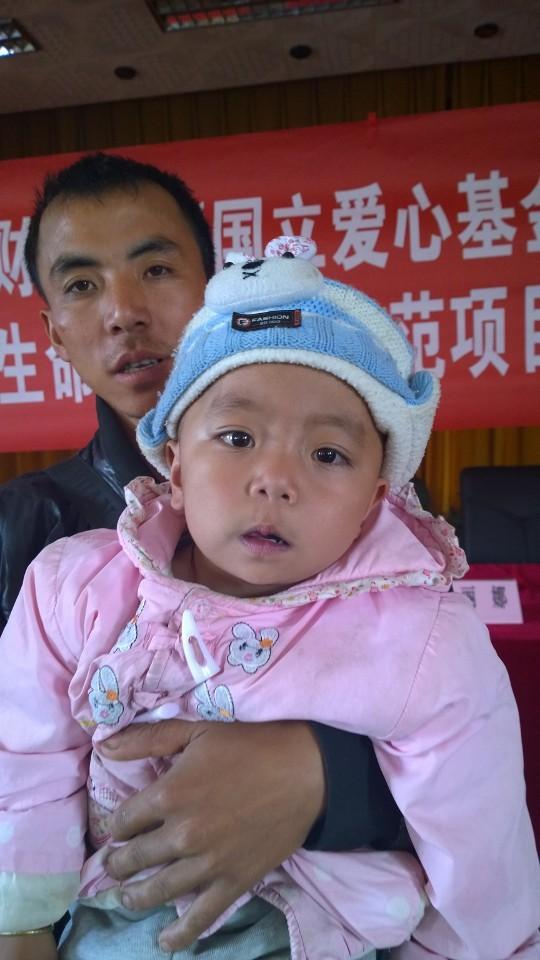 接受手术以后的娃娃