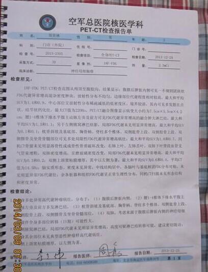 PET-CT肿瘤检查结果。