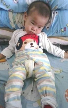 孩子不会翻身,不会坐起来,把她放成什么姿势就是什么姿势,这样一直保持着,多难受。