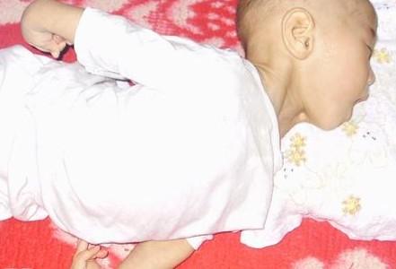 这是宝宝10个月的时候抽搐的样子,父母好无助。