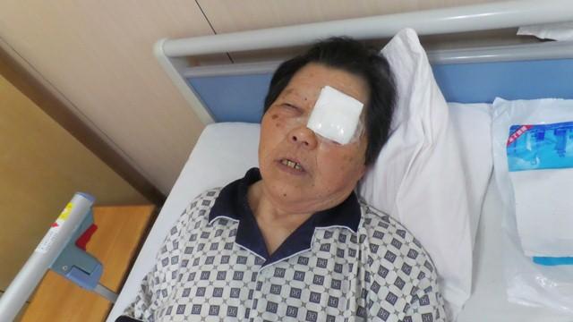 老人刚刚做完白内障手术,静卧休息。