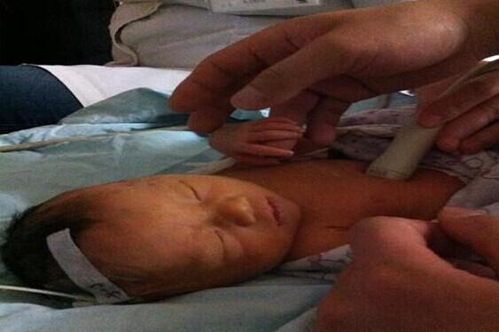 2013年5月12日:因查出小锶锶有心脏病,叫家长过去再确诊一次,小家伙好瘦哦,才出生一个多星期,头上已经挂起了药水。