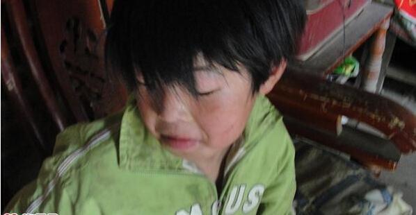 郭莹莹小时患病,因为家庭贫困,没有医疗,留下