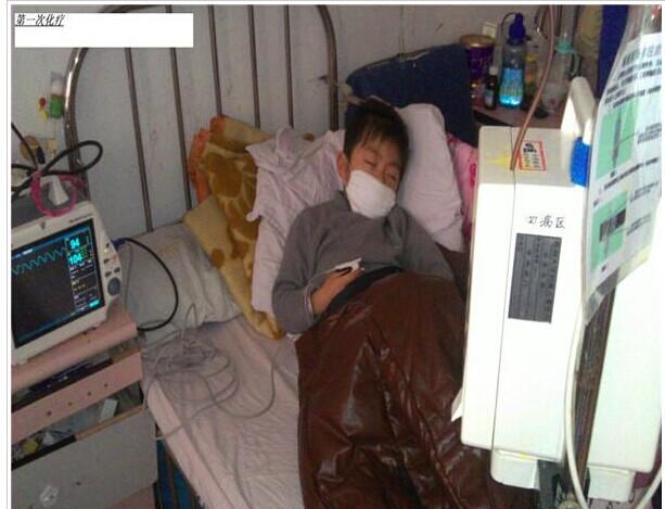 史晓宇第一次化疗