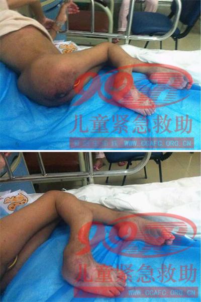 孩子照片