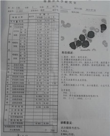 王凯的骨穿报告