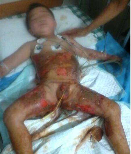 胡少忠基本是晕迷,休克状态。