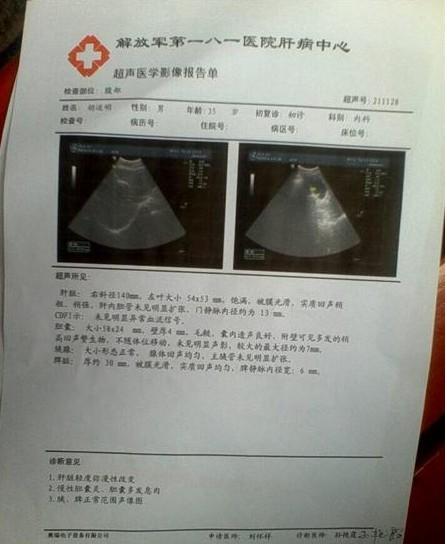 胡少忠父亲患有大三阳乙肝,轻度肝硬化,胆囊炎,胆囊积肉等疾病。