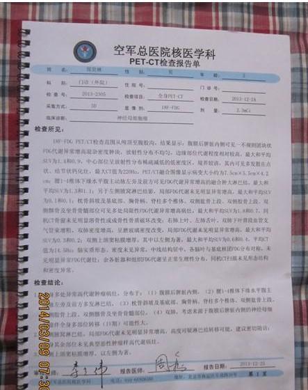 PET-CT肿瘤检查结果。