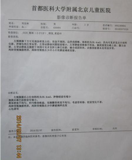 这是化疗两个疗程结束后增强CT的结果。