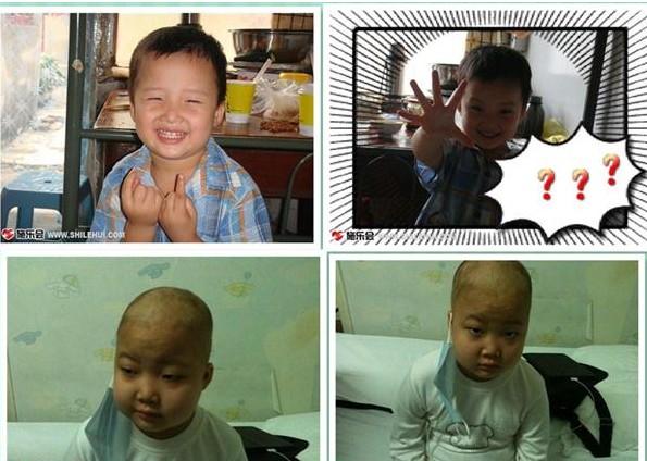 生病前的小美雯,脸上洋溢着幸福的笑容,生病后的她已失去当时的天真,剩下的只有病魔带来的无助和被折磨后的憔悴。