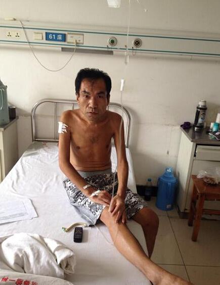 王明礼今年40岁,不幸患上包涵体肌病,身体无力,失去劳动能力