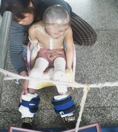 浩冉在做康复训练。