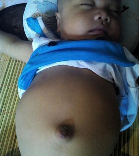 小毅帆小小年纪就患上了重病,非常可怜。