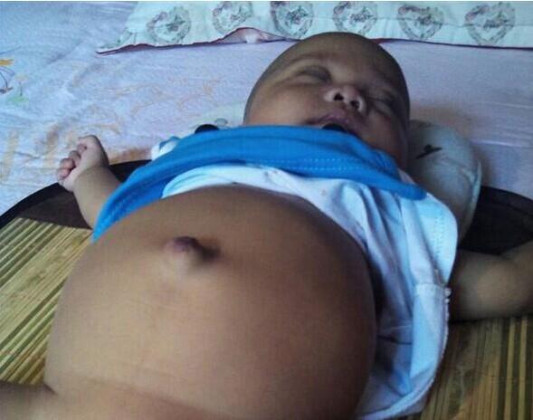 因没钱住院,小毅帆平时只能在家里。