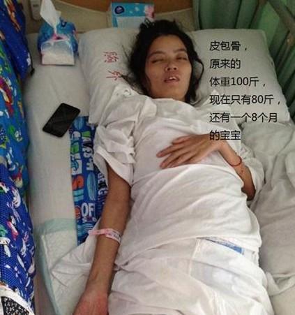 手术前,昏迷在病床上的蔡观纯,精神萎靡。