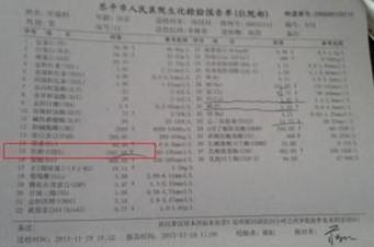 乐平市人民医院的生化检验报告单