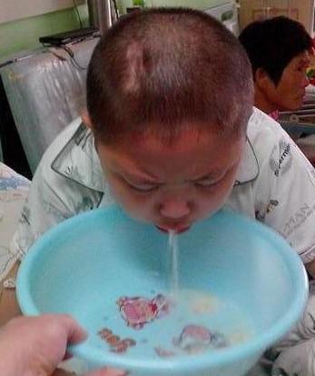 龙龙对化疗药物很敏感,肝功高,呕吐,发烧,口腔溃疡,脱发等副作用他无一幸免。此外还要定期进行腰穿、胸穿和血检,有时候腰穿不成功,疼得他泪水直流。