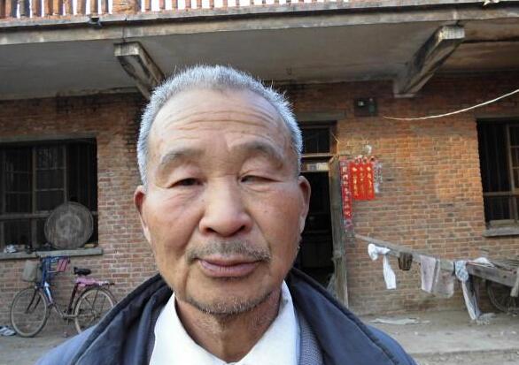 王荣歌的父亲的近照,父亲左眼失明是个残疾人