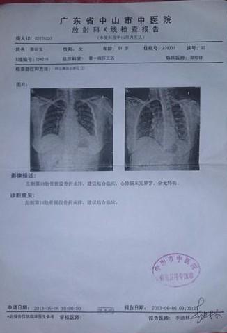 在中山市中医院治疗意外骨折的检查报告。
