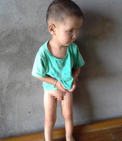 患病的汪嘉道。