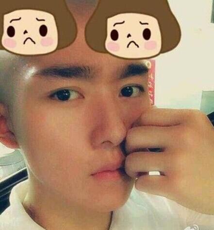 由于化疗,头发都掉光了