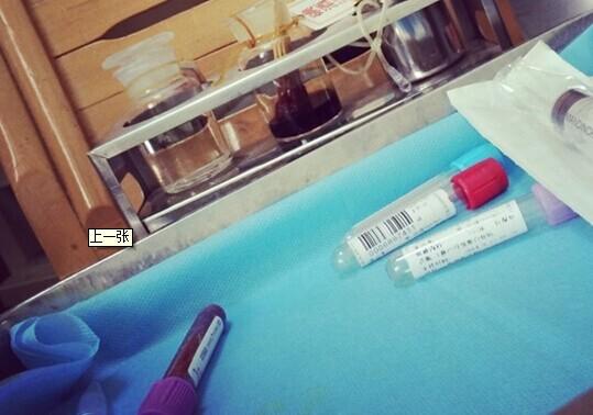 血清抽样
