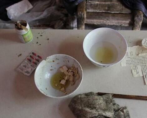 钱其应老人吃的很不营养