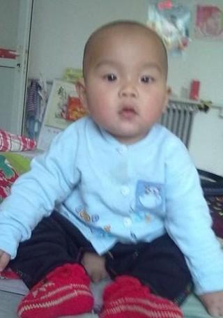 这是孩子健康时候的照片,圆圆胖胖的很可爱。
