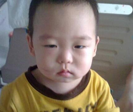 儿子刚生病的时候,那时候脸色特别不好看,血小板又低,脸上一碰就好多红点,病魔为什么要折磨这么小的孩子