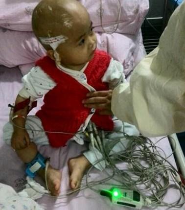 李柯珈这么小,看他身上就插满了各种的线。这是在做心电图检查。