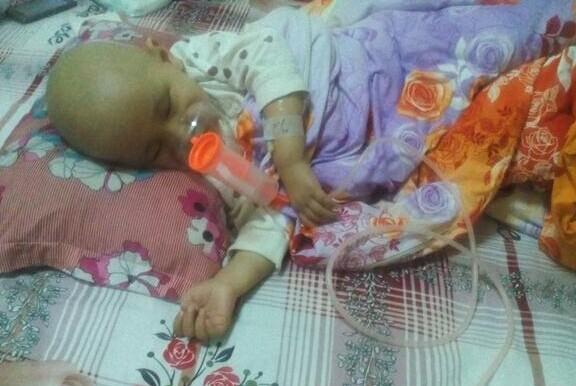 长时间的化疗让小云云抵抗力低下 这是小云云感冒咳嗽了 在做雾化 。