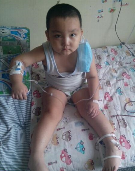 孩子只有4岁,有着坚强的内心,化疗中没有流一滴眼泪。