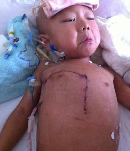 触目惊心的刀口,没想到那么大