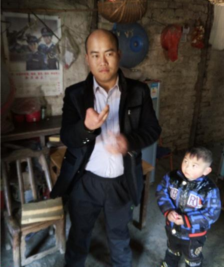 周敏的右手因事故造成肢体残疾，只有小拇指和无名指。