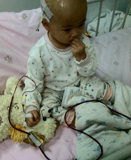 小柯珈在输血红蛋白。